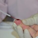 Secretaria de Saúde reforça importância da prevenção contra as hepatites virais