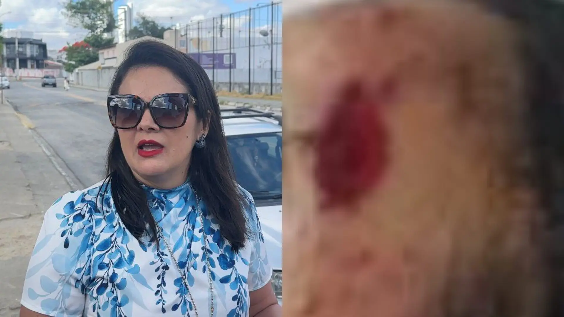 adolescente de 15 anos é estuprada e agredida em ingá após voltar de festa