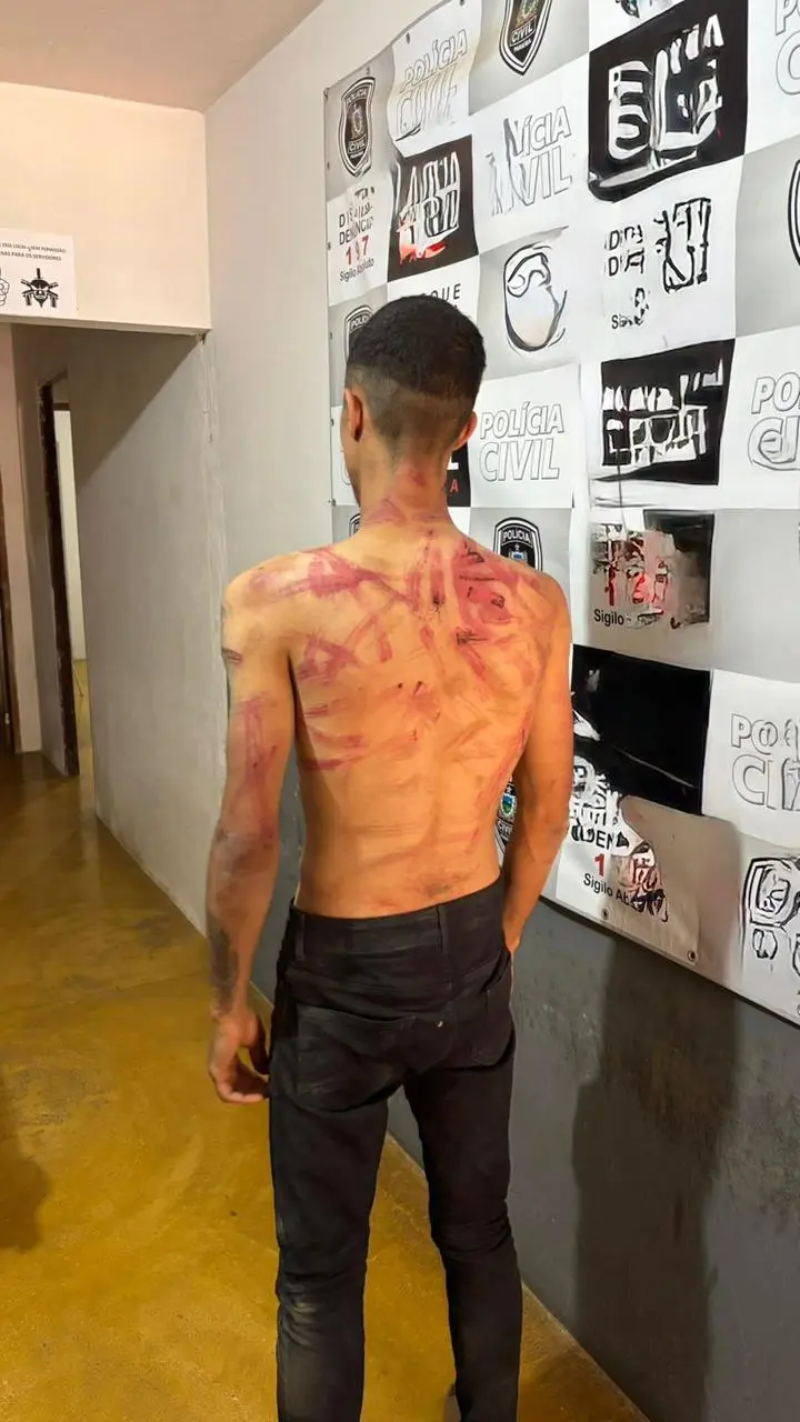 suspeito de assalto em cuité é preso após ser agredido por facção criminosa